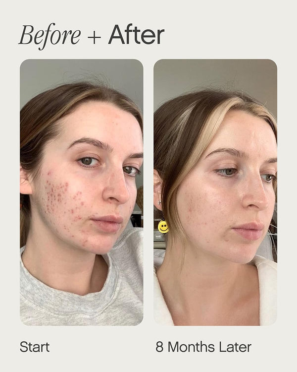 Faded Brightening Serum